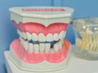 Was tun bei einem abgebrochenen Zahn?